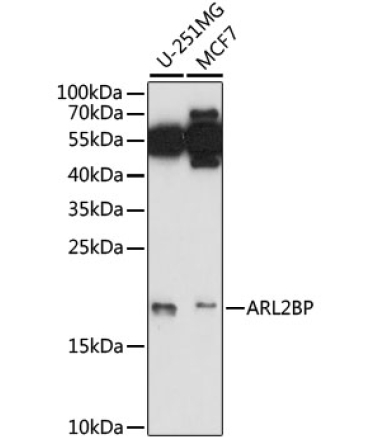 ARL2BP Rabbit Polyclonal Antibody