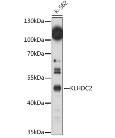 KLHDC2 Rabbit Polyclonal Antibody
