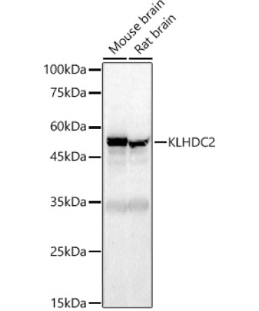 KLHDC2 Rabbit Polyclonal Antibody