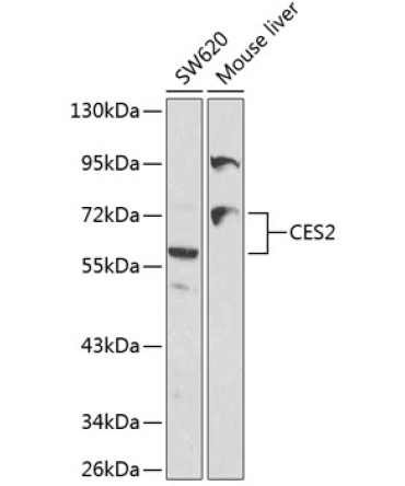 CES2 Rabbit Polyclonal Antibody