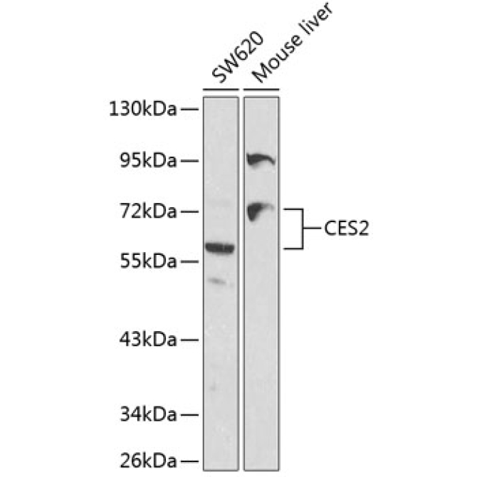 CES2 Rabbit Polyclonal Antibody