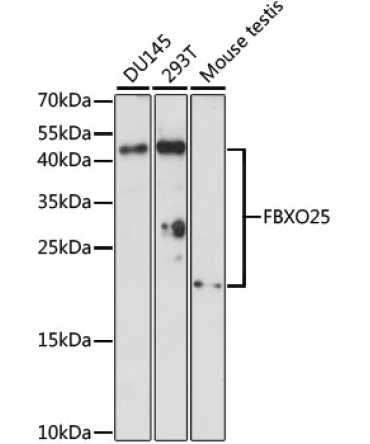 FBXO25 Rabbit Polyclonal Antibody