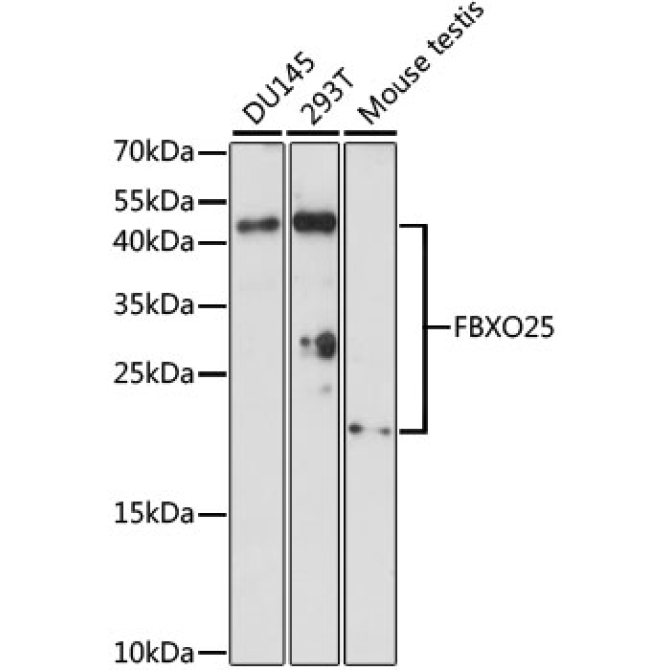 FBXO25 Rabbit Polyclonal Antibody