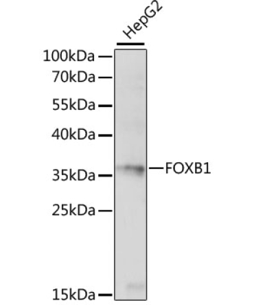 FOXB1 Rabbit Polyclonal Antibody