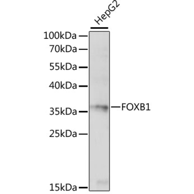 FOXB1 Rabbit Polyclonal Antibody