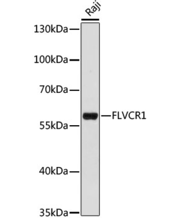 FLVCR1 Rabbit Polyclonal Antibody