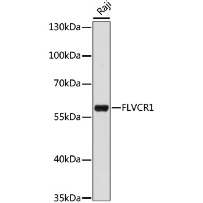 FLVCR1 Rabbit Polyclonal Antibody
