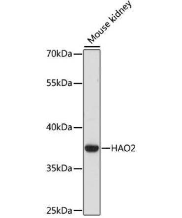 HAO2 Rabbit Polyclonal Antibody