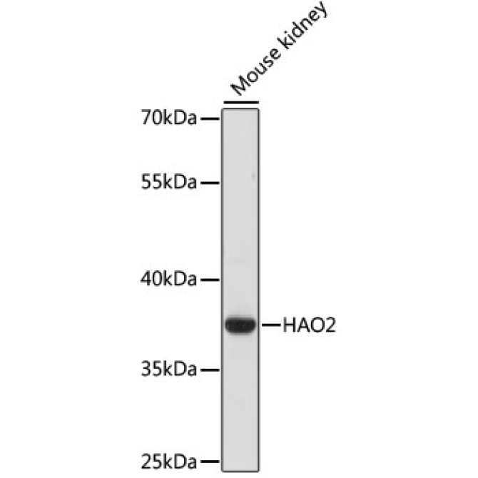 HAO2 Rabbit Polyclonal Antibody
