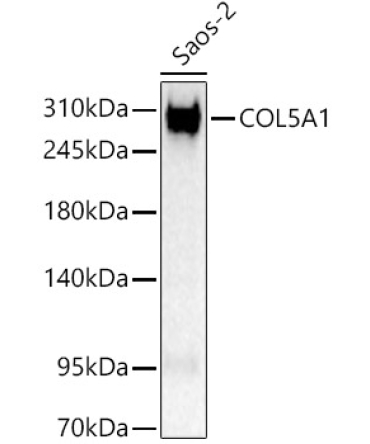 COL5A1 Rabbit Polyclonal Antibody