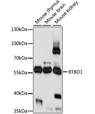 BTBD1 Rabbit Polyclonal Antibody