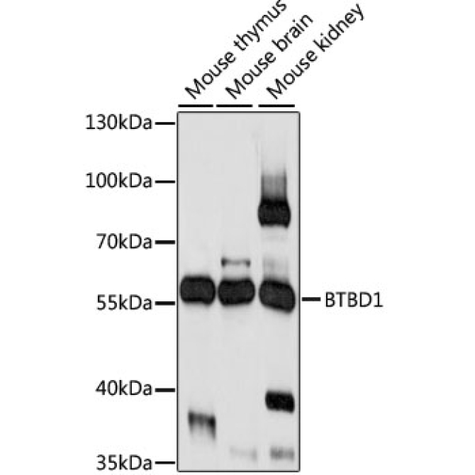 BTBD1 Rabbit Polyclonal Antibody