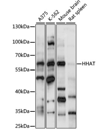 HHAT Rabbit Polyclonal Antibody