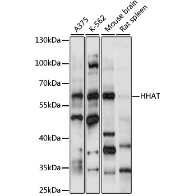 HHAT Rabbit Polyclonal Antibody