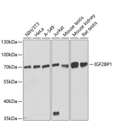 IGF2BP1/IMP1 Rabbit Polyclonal Antibody