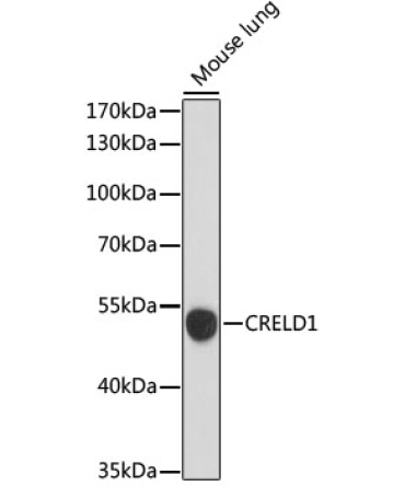 CRELD1 Rabbit Polyclonal Antibody