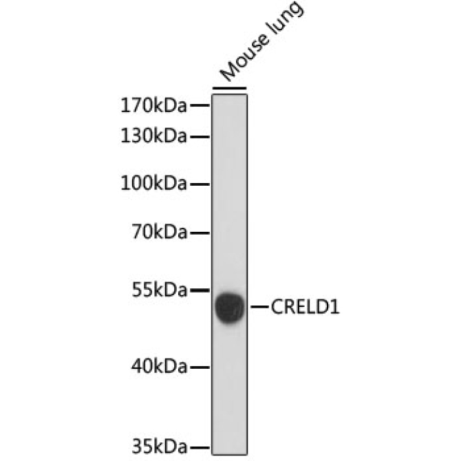 CRELD1 Rabbit Polyclonal Antibody