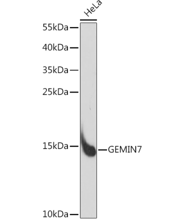 GEMIN7 Rabbit Polyclonal Antibody