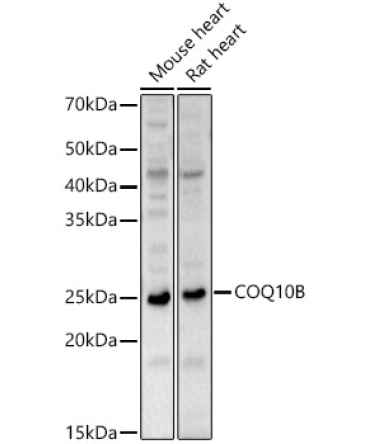 COQ10B Rabbit Polyclonal Antibody