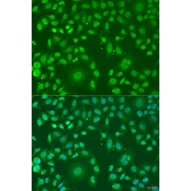 ARL6 Rabbit Polyclonal Antibody
