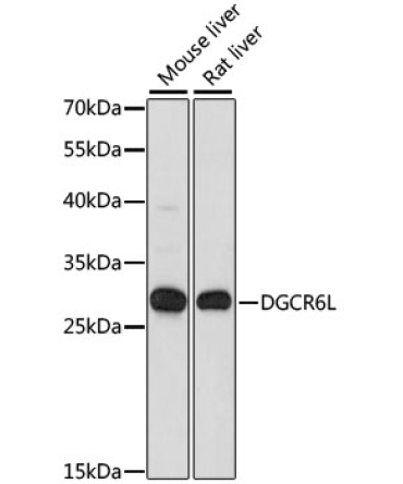 DGCR6L Rabbit Polyclonal Antibody