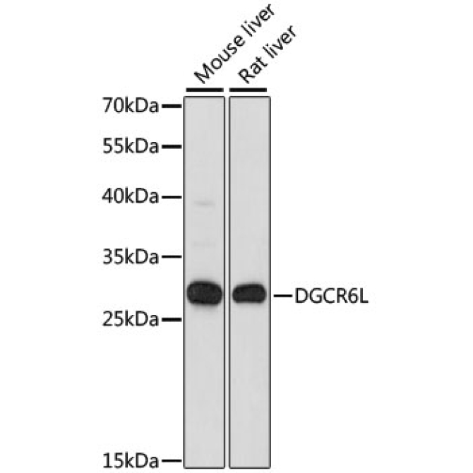 DGCR6L Rabbit Polyclonal Antibody