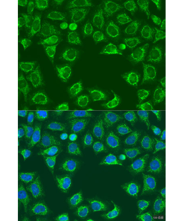 ALG2 Rabbit Polyclonal Antibody