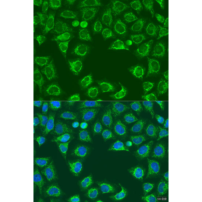 ALG2 Rabbit Polyclonal Antibody