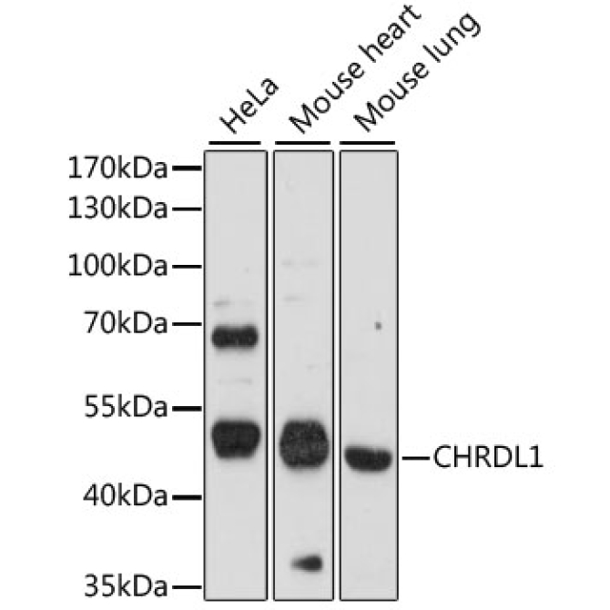 CHRDL1 Rabbit Polyclonal Antibody