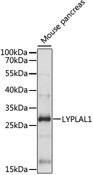 LYPLAL1 Rabbit Polyclonal Antibody