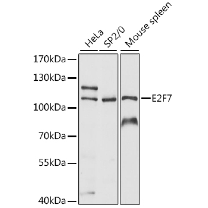 E2F7 Rabbit Polyclonal Antibody