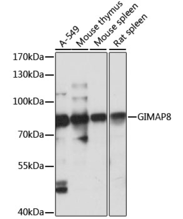 GIMAP8 Rabbit Polyclonal Antibody