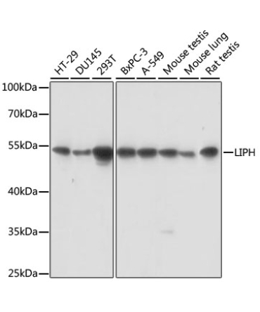LIPH Rabbit Polyclonal Antibody
