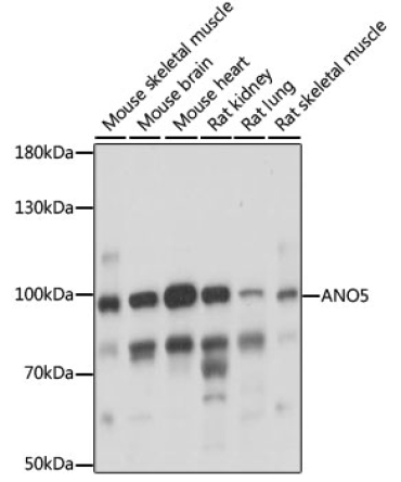 ANO5 Rabbit Polyclonal Antibody