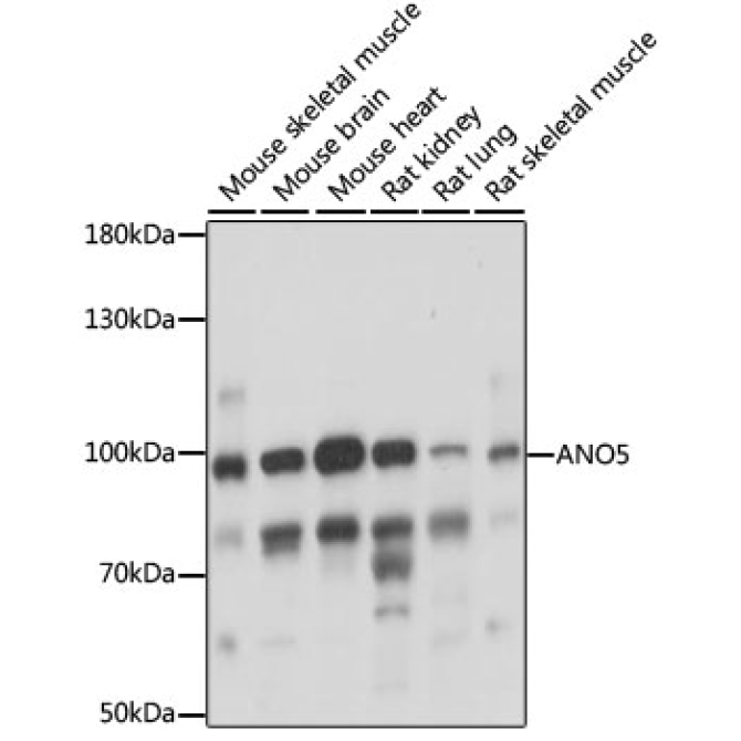 ANO5 Rabbit Polyclonal Antibody