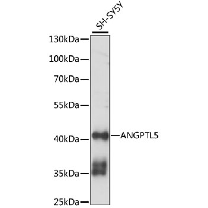 ANGPTL5 Rabbit Polyclonal Antibody