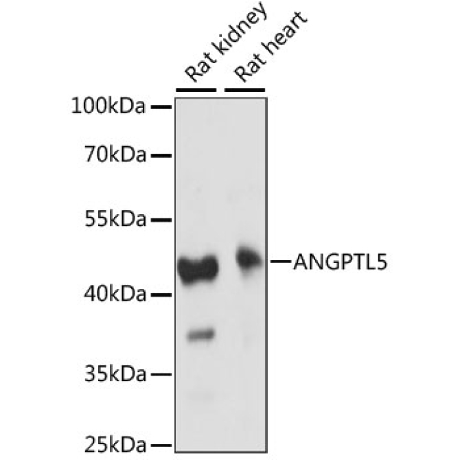 ANGPTL5 Rabbit Polyclonal Antibody