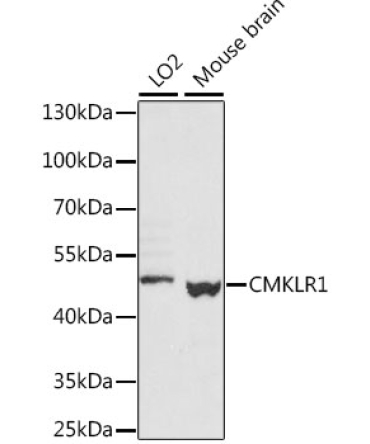 CMKLR1 Rabbit Polyclonal Antibody