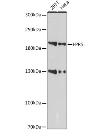 EPRS Rabbit Polyclonal Antibody