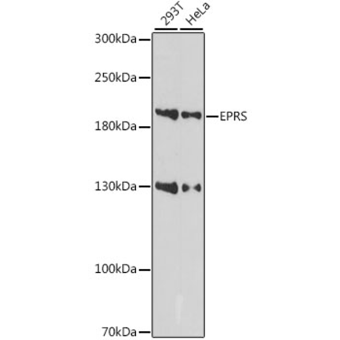 EPRS Rabbit Polyclonal Antibody