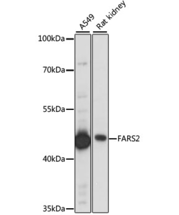FARS2 Rabbit Polyclonal Antibody