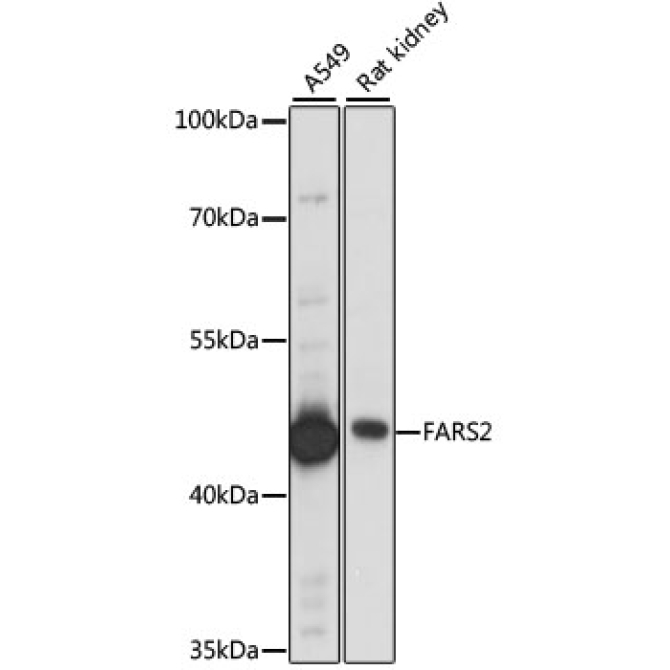 FARS2 Rabbit Polyclonal Antibody