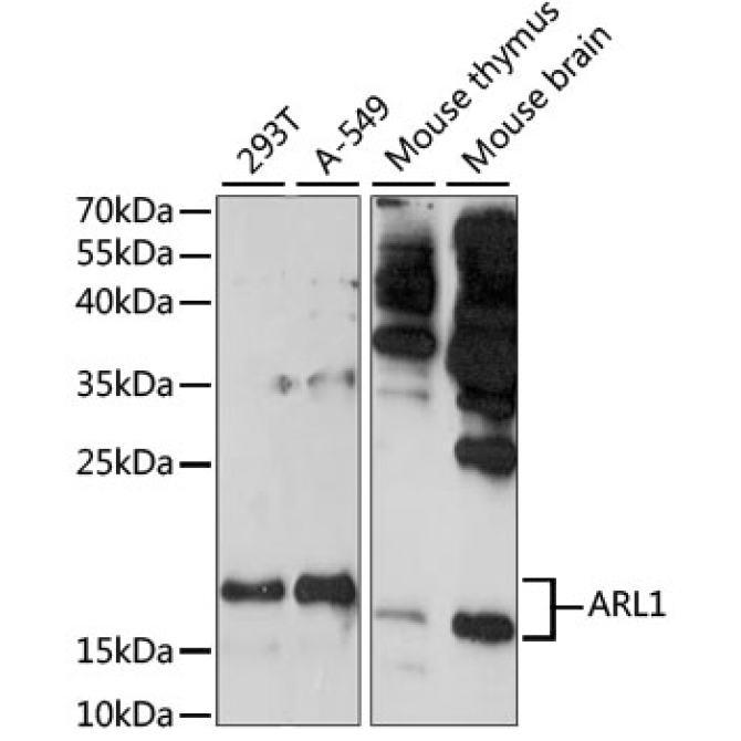 ARL1 Rabbit Polyclonal Antibody