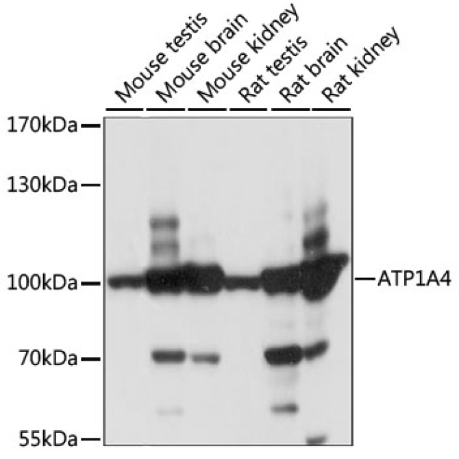 ATP1A4 Rabbit Polyclonal Antibody