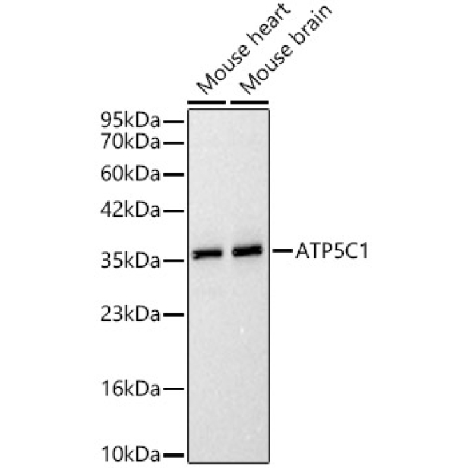 ATP5C1 Rabbit Polyclonal Antibody