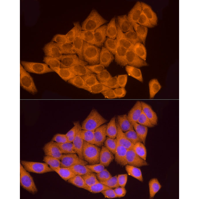 ATP6V0A1 Rabbit Polyclonal Antibody