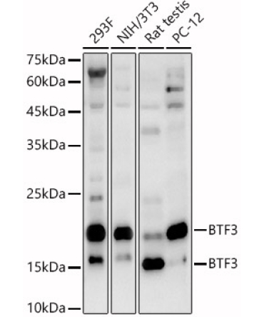 BTF3 Rabbit Polyclonal Antibody