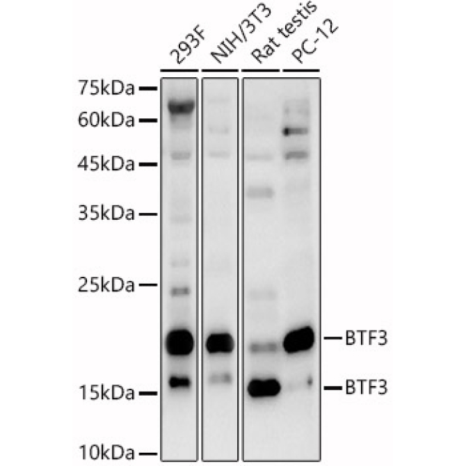 BTF3 Rabbit Polyclonal Antibody