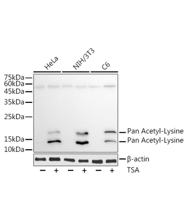 Pan Acetyl-Lysine Mouse Monoclonal Antibody