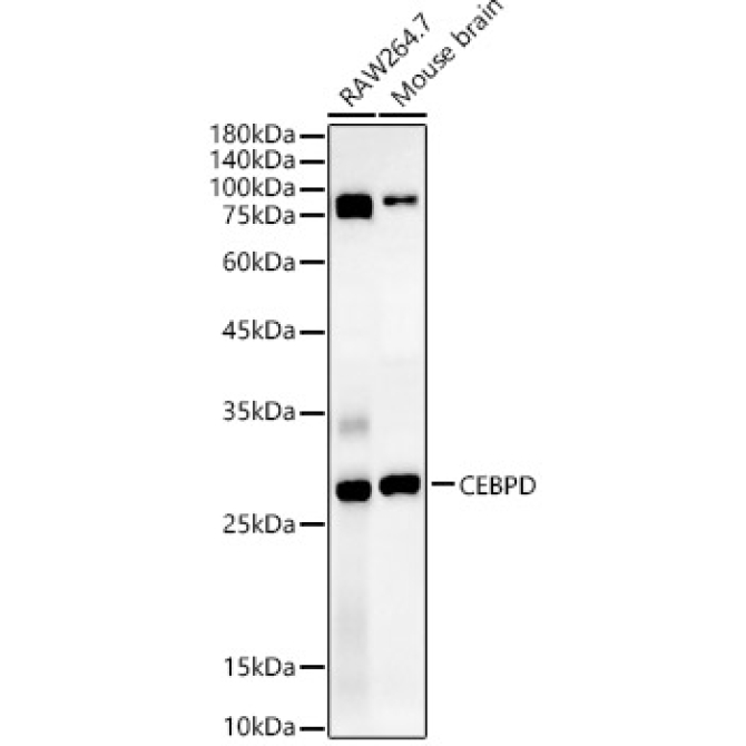 CEBP Delta/CEBPD Rabbit Polyclonal Antibody